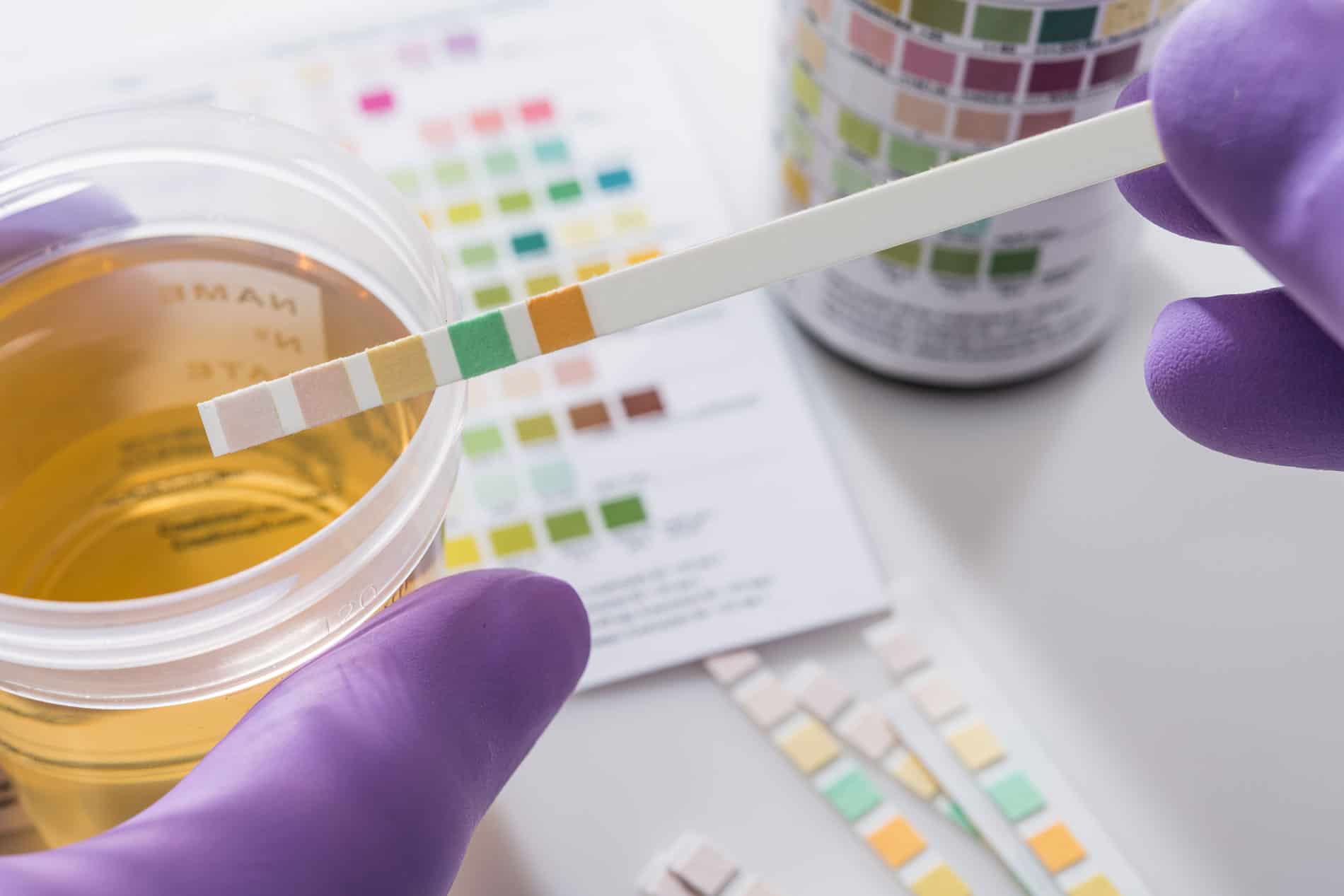 DOT vs. Non-DOT Drug Testing: What’s the Difference?