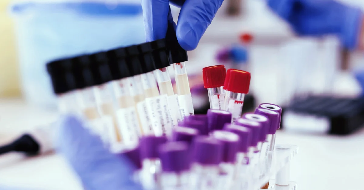 The Importance of Mobile Drug and Alcohol Testing in the Workplace